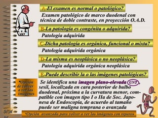 A-A-El examen es normal o patológico?El examen es normal o patológico?
Examen patológico de marco duodenal conExamen patológico de marco duodenal con
técnica de doble contraste, en proyección O.A.D.técnica de doble contraste, en proyección O.A.D.
B-B-La patología es congénita o adquirida?La patología es congénita o adquirida?
Patología adquiridaPatología adquirida
D-D-La misma es neoplásica o no neoplásica?La misma es neoplásica o no neoplásica?
**OpciónOpción
de volverde volver
a ver lasa ver las
imágenesimágenes
Patología adquirida orgánica neoplásicaPatología adquirida orgánica neoplásica
E-E-Puede describir la o las imágenes patológicas?Puede describir la o las imágenes patológicas?
Se identifica unaSe identifica una imagen plano-elevadaimagen plano-elevada UNTUNT ,,
sesil, localizada en cara posterior de bulbosesil, localizada en cara posterior de bulbo
duodenal, próxima a la curvatura menor, com-duodenal, próxima a la curvatura menor, com-
patible con imagen tipo I o IIa de Soc. Japo-patible con imagen tipo I o IIa de Soc. Japo-
nesa de Endoscopía, de acuerdo al tamañonesa de Endoscopía, de acuerdo al tamaño
puede ser maligna temprana o avanzadapuede ser maligna temprana o avanzada
NMNM
C-C-Dicha patología es orgánica, funcional o mixta?Dicha patología es orgánica, funcional o mixta?
Patología adquirida orgánicaPatología adquirida orgánica
**Opción avanzada para volver a ver las imágenes con reparosOpción avanzada para volver a ver las imágenes con reparos
D. F. M.D. F. M.
UNTUNT
E ME M
UNTUNT
 
