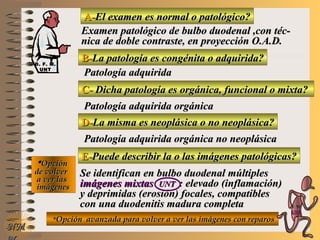 A-A-El examen es normal o patológico?El examen es normal o patológico?
Examen patológico de bulbo duodenal ,con téc-Examen patológico de bulbo duodenal ,con téc-
nica de doble contraste, en proyección O.A.D.nica de doble contraste, en proyección O.A.D.
B-B-La patología es congénita o adquirida?La patología es congénita o adquirida?
Patología adquiridaPatología adquirida
C-C- Dicha patología es orgánica, funcional o mixta?Dicha patología es orgánica, funcional o mixta?
**OpciónOpción
de volverde volver
a ver lasa ver las
imágenesimágenes
Patología adquirida orgánicaPatología adquirida orgánica
D-D-La misma es neoplásica o no neoplásica?La misma es neoplásica o no neoplásica?
Patología adquirida orgánica no neoplásicaPatología adquirida orgánica no neoplásica
E-E-Puede describir la o las imágenes patológicas?Puede describir la o las imágenes patológicas?
Se identifican en bulbo duodenal múltiplesSe identifican en bulbo duodenal múltiples
imágenes mixtasimágenes mixtas UNTUNT : elevado (inflamación): elevado (inflamación)
y deprimidas (erosión) focales, compatiblesy deprimidas (erosión) focales, compatibles
con una duodenitis madura completacon una duodenitis madura completa
**Opción avanzada para volver a ver las imágenes con reparosOpción avanzada para volver a ver las imágenes con reparos
NMNM
D. F. M.D. F. M.
UNTUNT
E ME M
UNTUNT
 