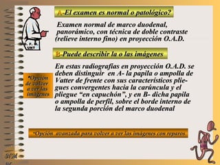 A-A-El examen es normal o patológico?El examen es normal o patológico?
Examen normal de marco duodenal,Examen normal de marco duodenal,
panorámico, con técnica de doble contrastepanorámico, con técnica de doble contraste
(relieve interno fino)(relieve interno fino) en proyección O.A.D.en proyección O.A.D.
B-B-Puede describir la o las imágenesPuede describir la o las imágenes
**OpciónOpción
de volverde volver
a ver lasa ver las
imágenesimágenes
En estas radiografías en proyección O.A.D. seEn estas radiografías en proyección O.A.D. se
deben distinguir en A- la papila o ampolla dedeben distinguir en A- la papila o ampolla de
Vatter de frente con sus característicos plie-Vatter de frente con sus característicos plie-
gues convergentes hacia la carúncula y elgues convergentes hacia la carúncula y el
pliegue “en capuchón”, y en B- dicha papilapliegue “en capuchón”, y en B- dicha papila
o ampolla de perfil, sobre el borde interno deo ampolla de perfil, sobre el borde interno de
la segunda porción del marco duodenalla segunda porción del marco duodenal
**Opción avanzada para volver a ver las imágenes con reparosOpción avanzada para volver a ver las imágenes con reparos
NMNM
D. F. M.D. F. M.
UNTUNT
E ME M
UNTUNT
 
