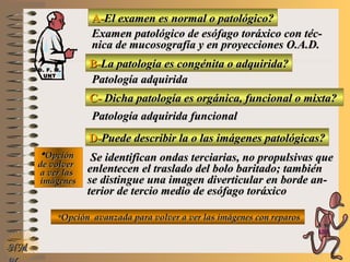 A-A-El examen es normal o patológico?El examen es normal o patológico?
Examen patológico de esófago toráxico con téc-Examen patológico de esófago toráxico con téc-
nica de mucosografía y en proyecciones O.A.D.nica de mucosografía y en proyecciones O.A.D.
B-B-La patología es congénita o adquirida?La patología es congénita o adquirida?
Patología adquiridaPatología adquirida
C-C- Dicha patología es orgánica, funcional o mixta?Dicha patología es orgánica, funcional o mixta?
**OpciónOpción
de volverde volver
a ver lasa ver las
imágenesimágenes
Patología adquirida funcionalPatología adquirida funcional
D-D-Puede describir la o las imágenes patológicas?Puede describir la o las imágenes patológicas?
Se identifican ondas terciarias, no propulsivas queSe identifican ondas terciarias, no propulsivas que
enlentecen el traslado del bolo baritado; tambiénenlentecen el traslado del bolo baritado; también
se distingue una imagen diverticular en borde an-se distingue una imagen diverticular en borde an-
terior de tercio medio de esófago toráxicoterior de tercio medio de esófago toráxico
**Opción avanzada para volver a ver las imágenes con reparosOpción avanzada para volver a ver las imágenes con reparos
NMNM
D. F. M.D. F. M.
UNTUNT
E ME M
UNTUNT
 