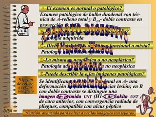 A-A-El examen es normal o patológico?El examen es normal o patológico?
Examen patológico de bulbo duodenal con téc-Examen patológico de bulbo duodenal con téc-
nica de A-relleno total y Bnica de A-relleno total y B1/21/2- doble contraste en- doble contraste en
proyección O.A.D.proyección O.A.D.
B-B-La patología es congénita o adquirida?La patología es congénita o adquirida?
Patología adquiridaPatología adquirida
C-C- Dicha patología es orgánica, funcional o mixta?Dicha patología es orgánica, funcional o mixta?
**OpciónOpción
de volverde volver
a ver lasa ver las
imágenesimágenes
Patología adquirida orgánicaPatología adquirida orgánica
D-D-La misma es neoplásica o no neoplásica?La misma es neoplásica o no neoplásica?
Patología adquirida orgánica no neoplásicaPatología adquirida orgánica no neoplásica
E-E-Puede describir la o las imágenes patológicas?Puede describir la o las imágenes patológicas?
Se identifican en el bulbo duodenal en A- unaSe identifican en el bulbo duodenal en A- una
deformación trebolar sin evidenciar lesión; en Bdeformación trebolar sin evidenciar lesión; en B
con doble contraste se distingue unacon doble contraste se distingue una
imagen de- primidaimagen de- primida UNTUNT (H1-2 de(H1-2 de SakitaSakita UNTUNT ))
de cara anterior, con convergencia radiada dede cara anterior, con convergencia radiada de
pliegues, compatible con ulcus pépticopliegues, compatible con ulcus péptico
**Opción avanzada para volver a ver las imágenes con reparosOpción avanzada para volver a ver las imágenes con reparos
NMNM
D. F. M.D. F. M.
UNTUNT
E ME M
UNTUNT
 