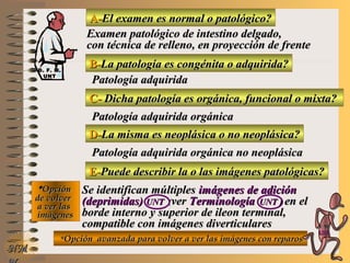 A-A-El examen es normal o patológico?El examen es normal o patológico?
Examen patológico de intestino delgado,Examen patológico de intestino delgado,
con técnica de relleno, en proyección de frentecon técnica de relleno, en proyección de frente
B-B-La patología es congénita o adquirida?La patología es congénita o adquirida?
Patología adquiridaPatología adquirida
C-C- Dicha patología es orgánica, funcional o mixta?Dicha patología es orgánica, funcional o mixta?
**OpciónOpción
de volverde volver
a ver lasa ver las
imágenesimágenes
Patología adquirida orgánicaPatología adquirida orgánica
D-D-La misma es neoplásica o no neoplásica?La misma es neoplásica o no neoplásica?
Patología adquirida orgánica no neoplásicaPatología adquirida orgánica no neoplásica
E-E-Puede describir la o las imágenes patológicas?Puede describir la o las imágenes patológicas?
Se identifican múltiplesSe identifican múltiples imágenes de adiciónimágenes de adición
(deprimidas)(deprimidas) UNTUNT ((verver TerminologíaTerminología UNTUNT )) en elen el
borde interno y superior de ileon terminal,borde interno y superior de ileon terminal,
compatible con imágenes diverticularescompatible con imágenes diverticulares
**Opción avanzada para volver a ver las imágenes con reparosOpción avanzada para volver a ver las imágenes con reparos
NMNM
D. F. M.D. F. M.
UNTUNT
E ME M
UNTUNT
 