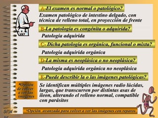 A-A-El examen es normal o patológico?El examen es normal o patológico?
Examen patológico de intestino delgado, conExamen patológico de intestino delgado, con
técnica de relleno total, en proyección de frentetécnica de relleno total, en proyección de frente
B-B-La patología es congénita o adquirida?La patología es congénita o adquirida?
Patología adquiridaPatología adquirida
C-C- Dicha patología es orgánica, funcional o mixta?Dicha patología es orgánica, funcional o mixta?
**OpciónOpción
de volverde volver
a ver lasa ver las
imágenesimágenes
Patología adquirida orgánicaPatología adquirida orgánica
D-D-La misma es neoplásica o no neoplásica?La misma es neoplásica o no neoplásica?
Patología adquirida orgánica no neoplásicaPatología adquirida orgánica no neoplásica
E-E-Puede describir la o las imágenes patológicas?Puede describir la o las imágenes patológicas?
Se identifican múltiples imágenes radio lúcidas,Se identifican múltiples imágenes radio lúcidas,
largas, que transcurren por distintas asas delargas, que transcurren por distintas asas de
íleon, alterando el relleno normal, compatibleíleon, alterando el relleno normal, compatible
con parásitoscon parásitos
**Opción avanzada para volver a ver las imágenes con reparosOpción avanzada para volver a ver las imágenes con reparosNMNM
D. F. M.D. F. M.
UNTUNT
E ME M
UNTUNT
 