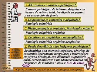 A-A-El examen es normal o patológico?El examen es normal o patológico?
Examen patológico de intestino delgado, conExamen patológico de intestino delgado, con
técnica de relleno total, localizada en yeyunotécnica de relleno total, localizada en yeyuno
y en proyección de frentey en proyección de frente
B-B-La patología es congénita o adquirida?La patología es congénita o adquirida?
Patología adquiridaPatología adquirida
D-D-La misma es neoplásica o no neoplásica?La misma es neoplásica o no neoplásica?
**OpciónOpción
de volverde volver
a ver lasa ver las
imágenesimágenes
Patología adquirida orgánica neoplásicaPatología adquirida orgánica neoplásica
E-E-Puede describir la o las imágenes patológicas?Puede describir la o las imágenes patológicas?
Se identifica una estenosis orgánica, céntrica, deSe identifica una estenosis orgánica, céntrica, de
contornos ligeramente irregulares y heterogéneacontornos ligeramente irregulares y heterogénea
en yeyuno proximal, con dilatación supraestric-en yeyuno proximal, con dilatación supraestric-
tural, correspondiente a un adenocarcinoma entural, correspondiente a un adenocarcinoma en
“mordisco de manzana” símil a“mordisco de manzana” símil a C.A. de colonC.A. de colon
UNTUNT
NMNM
C-C-Dicha patología es orgánica, funcional o mixta?Dicha patología es orgánica, funcional o mixta?
Patología adquirida orgánicaPatología adquirida orgánica
**Opción avanzada para volver a ver las imágenes con reparosOpción avanzada para volver a ver las imágenes con reparos
D. F. M.D. F. M.
UNTUNT
E ME M
UNTUNT
 