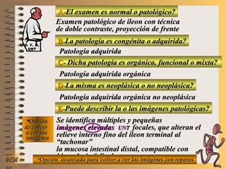 A-A-El examen es normal o patológico?El examen es normal o patológico?
Examen patológico de ileon con técnicaExamen patológico de ileon con técnica
de doble contraste, proyección de frentede doble contraste, proyección de frente
B-B-La patología es congénita o adquirida?La patología es congénita o adquirida?
Patología adquiridaPatología adquirida
C-C- Dicha patología es orgánica, funcional o mixta?Dicha patología es orgánica, funcional o mixta?
**OpciónOpción
de volverde volver
a ver lasa ver las
imágenesimágenes
Patología adquirida orgánicaPatología adquirida orgánica
D-D-La misma es neoplásica o no neoplásica?La misma es neoplásica o no neoplásica?
Patología adquirida orgánica no neoplásicaPatología adquirida orgánica no neoplásica
E-E-Puede describir la o las imágenes patológicas?Puede describir la o las imágenes patológicas?
Se identifica múltiples y pequeñasSe identifica múltiples y pequeñas
imágenes elevadasimágenes elevadas UNTUNT focales, que alteran elfocales, que alteran el
relieve interno fino del ileon terminal alrelieve interno fino del ileon terminal al
“tachonar”“tachonar”
la mucosa intestinal distal, compatible conla mucosa intestinal distal, compatible con
hiperplasia folicularhiperplasia folicular**Opción avanzada para volver a ver las imágenes con reparosOpción avanzada para volver a ver las imágenes con reparosNMNM
D. F. M.D. F. M.
UNTUNT
E ME M
UNTUNT
 