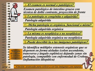 A-A-El examen es normal o patológico?El examen es normal o patológico?
Examen patológico de intestino grueso conExamen patológico de intestino grueso con
técnica de doble contraste, proyección de frentetécnica de doble contraste, proyección de frente
B-B-La patología es congénita o adquirida?La patología es congénita o adquirida?
Patología adquiridaPatología adquirida
C-C- Dicha patología es orgánica, funcional o mixta?Dicha patología es orgánica, funcional o mixta?
**OpciónOpción
de volverde volver
a ver lasa ver las
imágenesimágenes
Patología adquirida orgánicaPatología adquirida orgánica
D-D-La misma es neoplásica o no neoplásica?La misma es neoplásica o no neoplásica?
Patología adquirida orgánica no neoplásicaPatología adquirida orgánica no neoplásica
E-E-Puede describir la o las imágenes patológicas?Puede describir la o las imágenes patológicas?
Se identifica múltiples estenosis orgánicas que seSe identifica múltiples estenosis orgánicas que se
disponen en forma aisladas (colon ascendente,disponen en forma aisladas (colon ascendente,
transverso y ángulo esplénico) dejando zonas sintransverso y ángulo esplénico) dejando zonas sin
patología, compatible con enfermedad de Crohnpatología, compatible con enfermedad de Crohn
(inflamación idiopática)(inflamación idiopática)
**Opción avanzada para volver a ver las imágenes con reparosOpción avanzada para volver a ver las imágenes con reparosNMNM
D. F. M.D. F. M.
UNTUNT
E ME M
UNTUNT
 