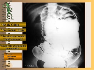 E ME M
UNTUNT
*Rx de Colon*Rx de Colon
**Proyección:Proyección:
**Técnica de examen:Técnica de examen:
**Segmento examinado:Segmento examinado:
*M. C.:*M. C.:
malestarmalestar
difusodifuso
NMNM
frentefrente
““doble contraste”doble contraste”
panorámicopanorámico
 