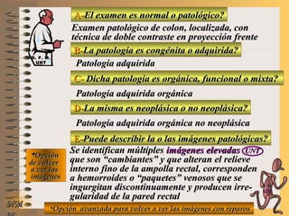 A-A-El examen es normal o patológico?El examen es normal o patológico?
Examen patológico de colon, localizada, conExamen patológico de colon, localizada, con
técnica de doble contraste en proyección frentetécnica de doble contraste en proyección frente
B-B-La patología es congénita o adquirida?La patología es congénita o adquirida?
Patología adquiridaPatología adquirida
C-C- Dicha patología es orgánica, funcional o mixta?Dicha patología es orgánica, funcional o mixta?
**OpciónOpción
de volverde volver
a ver lasa ver las
imágenesimágenes
Patología adquirida orgánicaPatología adquirida orgánica
D-D-La misma es neoplásica o no neoplásica?La misma es neoplásica o no neoplásica?
Patología adquirida orgánica no neoplásicaPatología adquirida orgánica no neoplásica
E-E-Puede describir la o las imágenes patológicas?Puede describir la o las imágenes patológicas?
Se identifican múltiplesSe identifican múltiples imágenes elevadasimágenes elevadas UNTUNT
que son “cambiantes” y que alteran el relieveque son “cambiantes” y que alteran el relieve
interno fino de la ampolla rectal, correspondeninterno fino de la ampolla rectal, corresponden
a hemorroides o “paquetes” venosos que sea hemorroides o “paquetes” venosos que se
ingurgitan discontinuamente y producen irre-ingurgitan discontinuamente y producen irre-
gularidad de la pared rectalgularidad de la pared rectal
**Opción avanzada para volver a ver las imágenes con reparosOpción avanzada para volver a ver las imágenes con reparos
NMNM
D. F. M.D. F. M.
UNTUNT
E ME M
UNTUNT
 