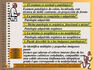 A-A-El examen es normal o patológico?El examen es normal o patológico?
Examen patológico de colon, localizada, conExamen patológico de colon, localizada, con
técnica de doble contraste, en proyección de frentetécnica de doble contraste, en proyección de frente
B-B-La patología es congénita o adquirida?La patología es congénita o adquirida?
Patología adquiridaPatología adquirida
C-C- Dicha patología es orgánica, funcional o mixta?Dicha patología es orgánica, funcional o mixta?
**OpciónOpción
de volverde volver
a ver lasa ver las
imágenesimágenes
Patología adquirida orgánicaPatología adquirida orgánica
D-D-La misma es neoplásica o no neoplásica?La misma es neoplásica o no neoplásica?
Patología adquirida orgánica no neoplásicaPatología adquirida orgánica no neoplásica
E-E-Puede describir la o las imágenes patológicas?Puede describir la o las imágenes patológicas?
Se identifica múltiples y pequeñas imágenesSe identifica múltiples y pequeñas imágenes
punti-punti-
formes que alteran el relieve interno fino de losformes que alteran el relieve interno fino de los
segmentos colónicos estudiados, compatible consegmentos colónicos estudiados, compatible con
una colitis ulcerosa (inflamación idiopática)una colitis ulcerosa (inflamación idiopática)
grado I que corresponde a la nodularidad, nó-grado I que corresponde a la nodularidad, nó-
tese la ausencia de haustras y abollonadurastese la ausencia de haustras y abollonaduras**Opción avanzada para volver a ver las imágenes con reparosOpción avanzada para volver a ver las imágenes con reparosNMNM
D. F. M.D. F. M.
UNTUNT
E ME M
UNTUNT
 