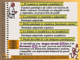 A-A-El examen es normal o patológico?El examen es normal o patológico?
Examen patológico de colon con técnica deExamen patológico de colon con técnica de
doble contraste, localizado en ampolla rectaldoble contraste, localizado en ampolla rectal
y sigmoides, en proyección de perfily sigmoides, en proyección de perfil
B-B-La patología es congénita o adquirida?La patología es congénita o adquirida?
Patología adquiridaPatología adquirida
D-D-La misma es neoplásica o no neoplásica?La misma es neoplásica o no neoplásica?
**OpciónOpción
de volverde volver
a ver lasa ver las
imágenesimágenes
Patología adquirida orgánica neoplásicaPatología adquirida orgánica neoplásica
E-E-Puede describir la o las imágenes patológicas?Puede describir la o las imágenes patológicas?
Se identifican unaSe identifican una imagen elevadaimagen elevada UNTUNT tipo I detipo I de
BorrmannBorrmann UNTUNT , la cual provoca una oclusión, la cual provoca una oclusión
intestinal con distensión abdominal y melena,intestinal con distensión abdominal y melena,
compatible con deformidad bilateral de paredcompatible con deformidad bilateral de pared
tipotipo d ++++
NMNM
C-C-Dicha patología es orgánica, funcional o mixta?Dicha patología es orgánica, funcional o mixta?
Patología adquirida orgánicaPatología adquirida orgánica
**Opción avanzada para volver a ver las imágenes con reparosOpción avanzada para volver a ver las imágenes con reparos
D. F. M.D. F. M.
UNTUNT
E ME M
UNTUNT
 