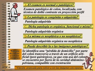 A-A-El examen es normal o patológico?El examen es normal o patológico?
Examen patológico de colon, localizada, conExamen patológico de colon, localizada, con
técnica de doble contraste en proyección perfiltécnica de doble contraste en proyección perfil
B-B-La patología es congénita o adquirida?La patología es congénita o adquirida?
Patología adquiridaPatología adquirida
C-C- Dicha patología es orgánica, funcional o mixta?Dicha patología es orgánica, funcional o mixta?
**OpciónOpción
de volverde volver
a ver lasa ver las
imágenesimágenes
Patología adquirida orgánicaPatología adquirida orgánica
D-D-La misma es neoplásica o no neoplásica?La misma es neoplásica o no neoplásica?
Patología adquirida orgánica no neoplásicaPatología adquirida orgánica no neoplásica
E-E-Puede describir la o las imágenes patológicas?Puede describir la o las imágenes patológicas?
Se identifica una “pérdida de domicilio” por parteSe identifica una “pérdida de domicilio” por parte
del colon transverso a través de un orificio arti-del colon transverso a través de un orificio arti-
ficial (post quirúrgico), ya que esta asa del colonficial (post quirúrgico), ya que esta asa del colon
se encuentra por fuera de la cavidad abdomino-se encuentra por fuera de la cavidad abdomino-
pelviana, compatible con eventraciónpelviana, compatible con eventración
**Opción avanzada para volver a ver las imágenes con reparosOpción avanzada para volver a ver las imágenes con reparosNMNM
D. F. M.D. F. M.
UNTUNT
E ME M
UNTUNT
 