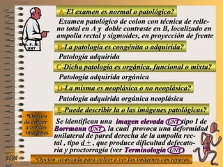 A-A-El examen es normal o patológico?El examen es normal o patológico?
Examen patológico de colon con técnica de relle-Examen patológico de colon con técnica de relle-
no total en A y doble contraste en B, localizado enno total en A y doble contraste en B, localizado en
ampolla rectal y sigmoides, en proyección de frenteampolla rectal y sigmoides, en proyección de frente
B-B-La patología es congénita o adquirida?La patología es congénita o adquirida?
Patología adquiridaPatología adquirida
D-D-La misma es neoplásica o no neoplásica?La misma es neoplásica o no neoplásica?
**OpciónOpción
de volverde volver
a ver lasa ver las
imágenesimágenes
Patología adquirida orgánica neoplásicaPatología adquirida orgánica neoplásica
E-E-Puede describir la o las imágenes patológicas?Puede describir la o las imágenes patológicas?
Se identifican unaSe identifican una imagen elevadaimagen elevada UNTUNT tipo I detipo I de
BorrmannBorrmann UNTUNT , la cual provoca una deformidad, la cual provoca una deformidad
unilateral de pared derecha de la ampolla rec-unilateral de pared derecha de la ampolla rec-
tal , tipotal , tipo d + , que produce dificultad defecato-, que produce dificultad defecato-
ria y proctorragia (verria y proctorragia (ver TerminologíaTerminología UNTUNT )
NMNM
C-C-Dicha patología es orgánica, funcional o mixta?Dicha patología es orgánica, funcional o mixta?
Patología adquirida orgánicaPatología adquirida orgánica
**Opción avanzada para volver a ver las imágenes con reparosOpción avanzada para volver a ver las imágenes con reparos
D. F. M.D. F. M.
UNTUNT
E ME M
UNTUNT
 