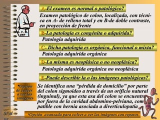 A-A-El examen es normal o patológico?El examen es normal o patológico?
Examen patológico de colon, localizada, con técni-Examen patológico de colon, localizada, con técni-
ca en A- de relleno total y en B-de doble contraste,ca en A- de relleno total y en B-de doble contraste,
en proyección de frenteen proyección de frente
B-B-La patología es congénita o adquirida?La patología es congénita o adquirida?
Patología adquiridaPatología adquirida
C-C- Dicha patología es orgánica, funcional o mixta?Dicha patología es orgánica, funcional o mixta?
**OpciónOpción
de volverde volver
a ver lasa ver las
imágenesimágenes
Patología adquirida orgánicaPatología adquirida orgánica
D-D-La misma es neoplásica o no neoplásica?La misma es neoplásica o no neoplásica?
Patología adquirida orgánica no neoplásicaPatología adquirida orgánica no neoplásica
E-E-Puede describir la o las imágenes patológicas?Puede describir la o las imágenes patológicas?
Se identifica una “pérdida de domicilio” por parteSe identifica una “pérdida de domicilio” por parte
del colon sigmoideo a través de un orificio naturaldel colon sigmoideo a través de un orificio natural
(inguinal), ya que esta asa del colon se encuentra(inguinal), ya que esta asa del colon se encuentra
por fuera de la cavidad abdomino-pelviana, com-por fuera de la cavidad abdomino-pelviana, com-
patible con hernia asociada a diverticulopatíapatible con hernia asociada a diverticulopatía
**Opción avanzada para volver a ver las imágenes con reparosOpción avanzada para volver a ver las imágenes con reparosNMNM
D. F. M.D. F. M.
UNTUNT
E ME M
UNTUNT
 