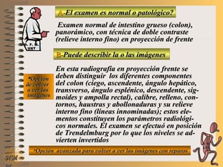 A-A-El examen es normal o patológico?El examen es normal o patológico?
Examen normal de intestino grueso (colon),Examen normal de intestino grueso (colon),
panorámico, con técnica de doble contrastepanorámico, con técnica de doble contraste
(relieve interno fino)(relieve interno fino) en proyección de frenteen proyección de frente
B-B-Puede describir la o las imágenesPuede describir la o las imágenes
**OpciónOpción
de volverde volver
a ver lasa ver las
imágenesimágenes
En esta radiografía en proyección frente seEn esta radiografía en proyección frente se
deben distinguir los diferentes componentesdeben distinguir los diferentes componentes
del colon (ciego, ascendente, ángulo hepático,del colon (ciego, ascendente, ángulo hepático,
transverso, ángulo esplénico, descendente, sig-transverso, ángulo esplénico, descendente, sig-
moides y ampolla rectal), calibre, relleno, con-moides y ampolla rectal), calibre, relleno, con-
tornos, haustras y abollonaduras y su relievetornos, haustras y abollonaduras y su relieve
interno fino (líneas innominadas); estos ele-interno fino (líneas innominadas); estos ele-
mentos constituyen los parámetros radiológi-mentos constituyen los parámetros radiológi-
cos normales. El examen se efectuó en posicióncos normales. El examen se efectuó en posición
de Trendelmburg por lo que los niveles se ad-de Trendelmburg por lo que los niveles se ad-
vierten invertidosvierten invertidos
**Opción avanzada para volver a ver las imágenes con reparosOpción avanzada para volver a ver las imágenes con reparos
NMNM
D. F. M.D. F. M.
UNTUNT
E ME M
UNTUNT
 