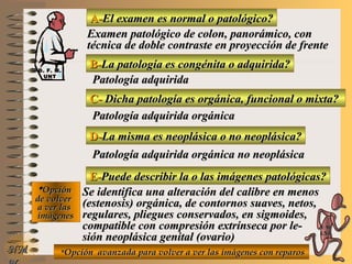 A-A-El examen es normal o patológico?El examen es normal o patológico?
Examen patológico de colon, panorámico, conExamen patológico de colon, panorámico, con
técnica de doble contraste en proyección de frentetécnica de doble contraste en proyección de frente
B-B-La patología es congénita o adquirida?La patología es congénita o adquirida?
Patología adquiridaPatología adquirida
C-C- Dicha patología es orgánica, funcional o mixta?Dicha patología es orgánica, funcional o mixta?
**OpciónOpción
de volverde volver
a ver lasa ver las
imágenesimágenes
Patología adquirida orgánicaPatología adquirida orgánica
D-D-La misma es neoplásica o no neoplásica?La misma es neoplásica o no neoplásica?
Patología adquirida orgánica no neoplásicaPatología adquirida orgánica no neoplásica
E-E-Puede describir la o las imágenes patológicas?Puede describir la o las imágenes patológicas?
Se identifica una alteración del calibre en menosSe identifica una alteración del calibre en menos
(estenosis) orgánica, de contornos suaves, netos,(estenosis) orgánica, de contornos suaves, netos,
regulares, pliegues conservados, en sigmoides,regulares, pliegues conservados, en sigmoides,
compatible con compresión extrínseca por le-compatible con compresión extrínseca por le-
sión neoplásica genital (ovario)sión neoplásica genital (ovario)
**Opción avanzada para volver a ver las imágenes con reparosOpción avanzada para volver a ver las imágenes con reparosNMNM
D. F. M.D. F. M.
UNTUNT
E ME M
UNTUNT
 