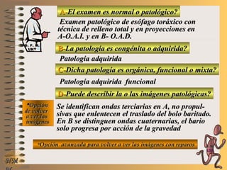 A-A-El examen es normal o patológico?El examen es normal o patológico?
Examen patológico de esófago toráxico conExamen patológico de esófago toráxico con
técnica de relleno total y en proyecciones entécnica de relleno total y en proyecciones en
A-O.A.I. y en B- O.A.D.A-O.A.I. y en B- O.A.D.
B-B-La patología es congénita o adquirida?La patología es congénita o adquirida?
Patología adquiridaPatología adquirida
**OpciónOpción
de volverde volver
a ver lasa ver las
imágenesimágenes
C-C-Dicha patología es orgánica, funcional o mixta?Dicha patología es orgánica, funcional o mixta?
Patología adquirida funcionalPatología adquirida funcional
D-D-Puede describir la o las imágenes patológicas?Puede describir la o las imágenes patológicas?
Se identifican ondas terciarias en A, no propul-Se identifican ondas terciarias en A, no propul-
sivas que enlentecen el traslado del bolo baritado.sivas que enlentecen el traslado del bolo baritado.
En B se distinguen ondas cuaternarias, el barioEn B se distinguen ondas cuaternarias, el bario
solo progresa por acción de la gravedadsolo progresa por acción de la gravedad
**Opción avanzada para volver a ver las imágenes con reparosOpción avanzada para volver a ver las imágenes con reparos
NMNM
D. F. M.D. F. M.
UNTUNT
E ME M
UNTUNT
 