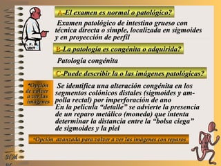 A-A-El examen es normal o patológico?El examen es normal o patológico?
Examen patológico de intestino grueso conExamen patológico de intestino grueso con
técnica directa o simple, localizada en sigmoidestécnica directa o simple, localizada en sigmoides
y en proyección de perfily en proyección de perfil
B-B-La patología es congénita o adquirida?La patología es congénita o adquirida?
Patología congénitaPatología congénita
C-C-Puede describir la o las imágenes patológicas?Puede describir la o las imágenes patológicas?
**OpciónOpción
de volverde volver
a ver lasa ver las
imágenesimágenes
Se identifica una alteración congénita en losSe identifica una alteración congénita en los
segmentos colónicos distales (sigmoides y am-segmentos colónicos distales (sigmoides y am-
polla rectal) por imperforación de anopolla rectal) por imperforación de ano
En la película “detalle” se advierte la presenciaEn la película “detalle” se advierte la presencia
de un reparo metálico (moneda) que intentade un reparo metálico (moneda) que intenta
determinar la distancia entre la “bolsa ciega”determinar la distancia entre la “bolsa ciega”
de sigmoides y la pielde sigmoides y la piel
**Opción avanzada para volver a ver las imágenes con reparosOpción avanzada para volver a ver las imágenes con reparos
NMNM
D. F. M.D. F. M.
UNTUNT
E ME M
UNTUNT
 