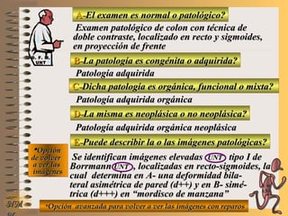 A-A-El examen es normal o patológico?El examen es normal o patológico?
Examen patológico de colon con técnica deExamen patológico de colon con técnica de
doble contraste, localizado en recto y sigmoides,doble contraste, localizado en recto y sigmoides,
en proyección de frenteen proyección de frente
B-B-La patología es congénita o adquirida?La patología es congénita o adquirida?
Patología adquiridaPatología adquirida
D-D-La misma es neoplásica o no neoplásica?La misma es neoplásica o no neoplásica?
**OpciónOpción
de volverde volver
a ver lasa ver las
imágenesimágenes
Patología adquirida orgánica neoplásicaPatología adquirida orgánica neoplásica
E-E-Puede describir la o las imágenes patológicas?Puede describir la o las imágenes patológicas?
Se identifican imágenes elevadasSe identifican imágenes elevadas UNTUNT tipo I detipo I de
BorrmannBorrmann UNTUNT , localizadas en recto-sigmoides, la, localizadas en recto-sigmoides, la
cual determina en A- una deformidad bila-cual determina en A- una deformidad bila-
teral asimétrica de pared (d++) y en B- simé-teral asimétrica de pared (d++) y en B- simé-
trica (d+++) en “mordisco de manzana”trica (d+++) en “mordisco de manzana”
NMNM
C-C-Dicha patología es orgánica, funcional o mixta?Dicha patología es orgánica, funcional o mixta?
Patología adquirida orgánicaPatología adquirida orgánica
**Opción avanzada para volver a ver las imágenes con reparosOpción avanzada para volver a ver las imágenes con reparos
D. F. M.D. F. M.
UNTUNT
E ME M
UNTUNT
 