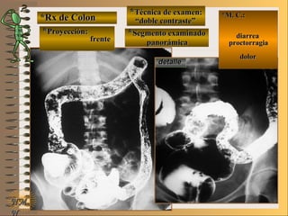 *Rx de Colon*Rx de Colon
**Proyección:Proyección:
**Técnica de examen:Técnica de examen:
**Segmento examinadoSegmento examinadoE ME M
UNTUNT
*M. C.:*M. C.:
diarreadiarrea
proctorragiaproctorragia
dolordolor
NMNM
N
detalledetalle
frentefrente
““doble contraste”doble contraste”
panorámicapanorámica
 