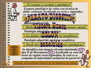 A-A-El examen es normal o patológico?El examen es normal o patológico?
Examen patológico de colon con técnica deExamen patológico de colon con técnica de
doble contraste, localizado en recto y sigmoides,doble contraste, localizado en recto y sigmoides,
en A-proyección de frente y en B-de perfilen A-proyección de frente y en B-de perfil
B-B-La patología es congénita o adquirida?La patología es congénita o adquirida?
Patología adquiridaPatología adquirida
D-D-La misma es neoplásica o no neoplásica?La misma es neoplásica o no neoplásica?
**OpciónOpción
de volverde volver
a ver lasa ver las
imágenesimágenes
Patología adquirida orgánica neoplásicaPatología adquirida orgánica neoplásica
E-E-Puede describir la o las imágenes patológicas?Puede describir la o las imágenes patológicas?
Se identifica una imagen elevado-deprimidaSe identifica una imagen elevado-deprimida UNTUNT
tipo II de Borrmanntipo II de Borrmann UNTUNT , localizada en cara an-, localizada en cara an-
terior de región recto-sigmoidea, la cual se a-terior de región recto-sigmoidea, la cual se a-
compaña de deformidad unilateral de pared (d+)compaña de deformidad unilateral de pared (d+)
NMNM
C-C-Dicha patología es orgánica, funcional o mixta?Dicha patología es orgánica, funcional o mixta?
Patología adquirida orgánicaPatología adquirida orgánica
**Opción avanzada para volver a ver las imágenes con reparosOpción avanzada para volver a ver las imágenes con reparos
D. F. M.D. F. M.
UNTUNT
E ME M
UNTUNT
 