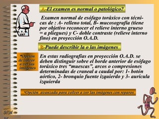 A-A-El examen es normal o patológico?El examen es normal o patológico?
Examen normal de esófago toráxico con técni-Examen normal de esófago toráxico con técni-
cas de : A- relleno total, B- mucosografía (tienecas de : A- relleno total, B- mucosografía (tiene
por objetivo reconocer el relieve interno gruesopor objetivo reconocer el relieve interno grueso
= a pliegues) y C- doble contraste (relieve interno= a pliegues) y C- doble contraste (relieve interno
fino) en proyección O.A.D.fino) en proyección O.A.D.
B-B-Puede describir la o las imágenesPuede describir la o las imágenes
**OpciónOpción
de volverde volver
a ver lasa ver las
imágenesimágenes
En estas radiografías en proyección O.A.D. seEn estas radiografías en proyección O.A.D. se
deben distinguir sobre el borde anterior de esófagodeben distinguir sobre el borde anterior de esófago
toráxico tres “muescas”, arcos o compresionestoráxico tres “muescas”, arcos o compresiones
determinadas de craneal a caudal por: 1- botóndeterminadas de craneal a caudal por: 1- botón
aórtico, 2- bronquio fuente izquierdo y 3- aurículaaórtico, 2- bronquio fuente izquierdo y 3- aurícula
izquierdaizquierda
**Opción avanzada para volver a ver las imágenes con reparosOpción avanzada para volver a ver las imágenes con reparos
NMNM
D. F. M.D. F. M.
UNTUNT
E ME M
UNTUNT
 