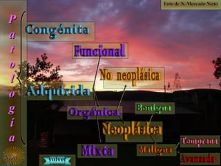 PP
aa
tt
oo
ll
oo
gg
íí
aa
NMNM volvervolver
Foto de N. Mercado NietoFoto de N. Mercado Nieto
 