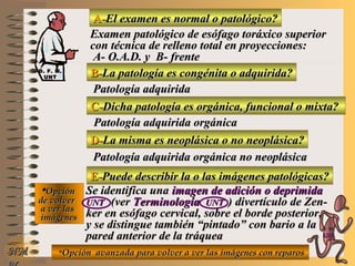 A-A-El examen es normal o patológico?El examen es normal o patológico?
Examen patológico de esófago toráxico superiorExamen patológico de esófago toráxico superior
con técnica de relleno total en proyecciones:con técnica de relleno total en proyecciones:
A- O.A.D. y B- frenteA- O.A.D. y B- frente
B-B-La patología es congénita o adquirida?La patología es congénita o adquirida?
Patología adquiridaPatología adquirida
C-C-Dicha patología es orgánica, funcional o mixta?Dicha patología es orgánica, funcional o mixta?
**OpciónOpción
de volverde volver
a ver lasa ver las
imágenesimágenes
D-D-La misma es neoplásica o no neoplásica?La misma es neoplásica o no neoplásica?
Patología adquirida orgánica no neoplásicaPatología adquirida orgánica no neoplásica
E-E-Puede describir la o las imágenes patológicas?Puede describir la o las imágenes patológicas?
Se identifica unaSe identifica una imagen de adición o deprimidaimagen de adición o deprimida
UNTUNT (ver(ver TerminologíaTerminología UNTUNT )) divertículo de Zen-divertículo de Zen-
ker en esófago cervical, sobre el borde posterior,ker en esófago cervical, sobre el borde posterior,
y se distingue también “pintado” con bario a lay se distingue también “pintado” con bario a la
pared anterior de la tráqueapared anterior de la tráquea
**Opción avanzada para volver a ver las imágenes con reparosOpción avanzada para volver a ver las imágenes con reparosNMNM
Patología adquirida orgánicaPatología adquirida orgánica
D. F. M.D. F. M.
UNTUNT
E ME M
UNTUNT
 