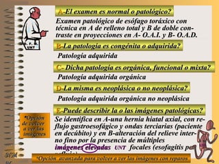 A-A-El examen es normal o patológico?El examen es normal o patológico?
Examen patológico de esófago toráxico conExamen patológico de esófago toráxico con
técnica en A de relleno total y B de doble con-técnica en A de relleno total y B de doble con-
traste en proyecciones en A- O.A.I. y B- O.A.D.traste en proyecciones en A- O.A.I. y B- O.A.D.
B-B-La patología es congénita o adquirida?La patología es congénita o adquirida?
Patología adquiridaPatología adquirida
C-C- Dicha patología es orgánica, funcional o mixta?Dicha patología es orgánica, funcional o mixta?
**OpciónOpción
de volverde volver
a ver lasa ver las
imágenesimágenes
Patología adquirida orgánicaPatología adquirida orgánica
D-D-La misma es neoplásica o no neoplásica?La misma es neoplásica o no neoplásica?
Patología adquirida orgánica no neoplásicaPatología adquirida orgánica no neoplásica
E-E-Puede describir la o las imágenes patológicas?Puede describir la o las imágenes patológicas?
Se identifica en A-una hernia hiatal axial, con re-Se identifica en A-una hernia hiatal axial, con re-
flujo gastroesofágico y ondas terciarias (pacienteflujo gastroesofágico y ondas terciarias (paciente
en decúbito) y en B-alteración del relieve inter-en decúbito) y en B-alteración del relieve inter-
no fino por la presencia de múltiplesno fino por la presencia de múltiples
imágenes elevadasimágenes elevadas UNTUNT focales (esofagítis porfocales (esofagítis por
reflujo)reflujo)NMNM **Opción avanzada para volver a ver las imágenes con reparosOpción avanzada para volver a ver las imágenes con reparos
D. F. M.D. F. M.
UNTUNT
E ME M
UNTUNT
 