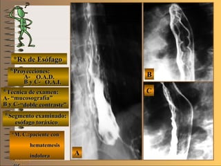 BB
AA
CC
E ME M
UNTUNT
NMNM
*Rx de Esófago*Rx de Esófago
**Proyecciones:Proyecciones:
A-A-
B y C-B y C-
**Técnica de examen:Técnica de examen:
A-A-
B y C-B y C-
**Segmento examinado:Segmento examinado:
*M. C.:paciente con*M. C.:paciente con
hematemesishematemesis
indoloraindolora
O.A.D.O.A.D.
O.A.I.O.A.I.
““mucosografía”mucosografía”
““doble contraste”doble contraste”
esófago toráxicoesófago toráxico
 