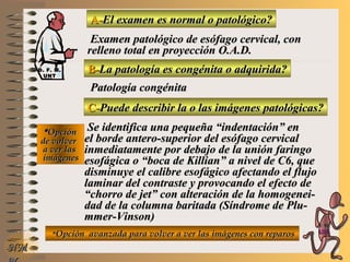 A-A-El examen es normal o patológico?El examen es normal o patológico?
Examen patológico de esófago cervical, conExamen patológico de esófago cervical, con
relleno total en proyección O.A.D.relleno total en proyección O.A.D.
B-B-La patología es congénita o adquirida?La patología es congénita o adquirida?
Patología congénitaPatología congénita
C-C-Puede describir la o las imágenes patológicas?Puede describir la o las imágenes patológicas?
**OpciónOpción
de volverde volver
a ver lasa ver las
imágenesimágenes
Se identifica una pequeña “indentación” enSe identifica una pequeña “indentación” en
el borde antero-superior del esófago cervicalel borde antero-superior del esófago cervical
inmediatamente por debajo de la unión faringoinmediatamente por debajo de la unión faringo
esofágica o “boca de Killian” a nivel de C6, queesofágica o “boca de Killian” a nivel de C6, que
disminuye el calibre esofágico afectando el flujodisminuye el calibre esofágico afectando el flujo
laminar del contraste y provocando el efecto delaminar del contraste y provocando el efecto de
““chorro de jet” con alteración de la homogenei-chorro de jet” con alteración de la homogenei-
dad de la columna baritada (Síndrome de Plu-dad de la columna baritada (Síndrome de Plu-
mmer-Vinson)mmer-Vinson)
**Opción avanzada para volver a ver las imágenes con reparosOpción avanzada para volver a ver las imágenes con reparos
NMNM
D. F. M.D. F. M.
UNTUNT
E ME M
UNTUNT
 