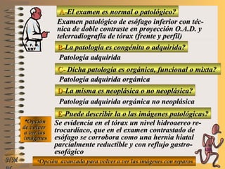 A-A-El examen es normal o patológico?El examen es normal o patológico?
Examen patológico de esófago inferior con téc-Examen patológico de esófago inferior con téc-
nica de doble contraste en proyección O.A.D. ynica de doble contraste en proyección O.A.D. y
telerradiografía de tórax (frente y perfil)telerradiografía de tórax (frente y perfil)
B-B-La patología es congénita o adquirida?La patología es congénita o adquirida?
Patología adquiridaPatología adquirida
C-C- Dicha patología es orgánica, funcional o mixta?Dicha patología es orgánica, funcional o mixta?
**OpciónOpción
de volverde volver
a ver lasa ver las
imágenesimágenes
Patología adquirida orgánicaPatología adquirida orgánica
D-D-La misma es neoplásica o no neoplásica?La misma es neoplásica o no neoplásica?
Patología adquirida orgánica no neoplásicaPatología adquirida orgánica no neoplásica
E-E-Puede describir la o las imágenes patológicas?Puede describir la o las imágenes patológicas?
Se evidencia en el tórax un nivel hidroaereo re-Se evidencia en el tórax un nivel hidroaereo re-
trocardíaco, que en el examen contrastado detrocardíaco, que en el examen contrastado de
esófago se corrobora como una hernia hiatalesófago se corrobora como una hernia hiatal
parcialmente reductible y con reflujo gastro-parcialmente reductible y con reflujo gastro-
esofágicoesofágico
**Opción avanzada para volver a ver las imágenes con reparosOpción avanzada para volver a ver las imágenes con reparosNMNM
D. F. M.D. F. M.
UNTUNT
E ME M
UNTUNT
 