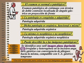 A-A-El examen es normal o patológico?El examen es normal o patológico?
Examen patológico de estómago con técnicaExamen patológico de estómago con técnica
de doble contraste localizada de ángulo gás-de doble contraste localizada de ángulo gás-
trico en proyección de frentetrico en proyección de frente
B-B-La patología es congénita o adquirida?La patología es congénita o adquirida?
Patología adquiridaPatología adquirida
D-D-La misma es neoplásica o no neoplásica?La misma es neoplásica o no neoplásica?
**OpciónOpción
de volverde volver
a ver lasa ver las
imágenesimágenes
Patología adquirida orgánica neoplásicaPatología adquirida orgánica neoplásica
E-E-Puede describir la o las imágenes patológicas?Puede describir la o las imágenes patológicas?
Se identifica una sutilSe identifica una sutil imagen plano deprimidaimagen plano deprimida
UNTUNT irregular y heterogénea en la incisura anguirregular y heterogénea en la incisura angu
laris gástrica con convergencia de pliegueslaris gástrica con convergencia de pliegues
hacia la misma, compatible con C.A. gástricohacia la misma, compatible con C.A. gástrico
tempranotemprano
NMNM
C-C-Dicha patología es orgánica, funcional o mixta?Dicha patología es orgánica, funcional o mixta?
Patología adquirida orgánicaPatología adquirida orgánica
**Opción avanzada para volver a ver las imágenes con reparosOpción avanzada para volver a ver las imágenes con reparos
D. F. M.D. F. M.
UNTUNT
E ME M
UNTUNT
 