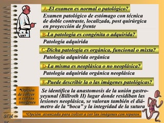 A-A-El examen es normal o patológico?El examen es normal o patológico?
Examen patológico de estómago con técnicaExamen patológico de estómago con técnica
de doble contraste, localizada, post quirúrgicade doble contraste, localizada, post quirúrgica
en proyección de frenteen proyección de frente
B-B-La patología es congénita o adquirida?La patología es congénita o adquirida?
Patología adquiridaPatología adquirida
D-D-La misma es neoplásica o no neoplásica?La misma es neoplásica o no neoplásica?
**OpciónOpción
de volverde volver
a ver lasa ver las
imágenesimágenes
Patología adquirida orgánica neoplásicaPatología adquirida orgánica neoplásica
E-E-Puede describir la o las imágenes patológicas?Puede describir la o las imágenes patológicas?
Se identifica la anastomosis de la unión gastro-Se identifica la anastomosis de la unión gastro-
yeyunal (Billroth II) lugar donde residiban lasyeyunal (Billroth II) lugar donde residiban las
lesiones neoplásica, se valoran también el diá-lesiones neoplásica, se valoran también el diá-
metro de la “boca” y la integridad de la suturametro de la “boca” y la integridad de la sutura
NMNM
C-C-Dicha patología es orgánica, funcional o mixta?Dicha patología es orgánica, funcional o mixta?
Patología adquirida orgánicaPatología adquirida orgánica
**Opción avanzada para volver a ver las imágenes con reparosOpción avanzada para volver a ver las imágenes con reparos
D. F. M.D. F. M.
UNTUNT
E ME M
UNTUNT
 