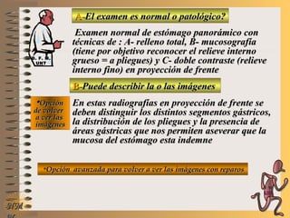 A-A-El examen es normal o patológico?El examen es normal o patológico?
Examen normal de estómago panorámico conExamen normal de estómago panorámico con
técnicas de : A- relleno total, B- mucosografíatécnicas de : A- relleno total, B- mucosografía
(tiene por objetivo reconocer el relieve interno(tiene por objetivo reconocer el relieve interno
grueso = a pliegues) y C- doble contraste (relievegrueso = a pliegues) y C- doble contraste (relieve
interno fino) en proyección de frenteinterno fino) en proyección de frente
B-B-Puede describir la o las imágenesPuede describir la o las imágenes
**OpciónOpción
de volverde volver
a ver lasa ver las
imágenesimágenes
En estas radiografías en proyección de frente seEn estas radiografías en proyección de frente se
deben distinguir los distintos segmentos gástricos,deben distinguir los distintos segmentos gástricos,
la distribución de los pliegues y la presencia dela distribución de los pliegues y la presencia de
áreas gástricas que nos permiten aseverar que laáreas gástricas que nos permiten aseverar que la
mucosa del estómago esta indemnemucosa del estómago esta indemne
**Opción avanzada para volver a ver las imágenes con reparosOpción avanzada para volver a ver las imágenes con reparos
NMNM
D. F. M.D. F. M.
UNTUNT
E ME M
UNTUNT
 