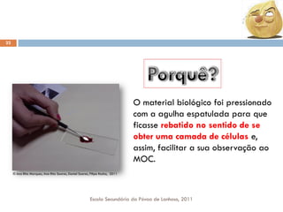 22

O material biológico foi pressionado
com a agulha espatulada para que
ficasse rebatido no sentido de se
obter uma camada de células e,
assim, facilitar a sua observação ao
MOC.
© Ana Rita Marques, Ana Rita Soares, Daniel Soares, Filipe Rocha, 2011

Escola Secundária da Póvoa de Lanhoso, 2011

 