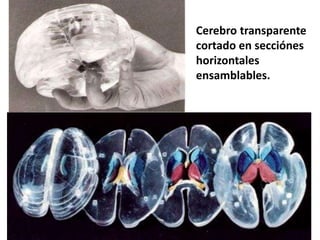 Cerebro transparente
cortado en secciónes
horizontales
ensamblables.

 