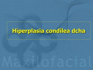 Hiperplasia condílea dcha 