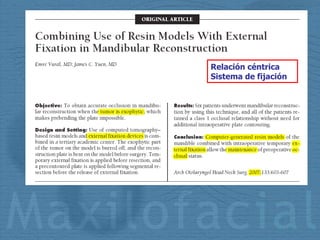 Relación céntrica Sistema de fijación 