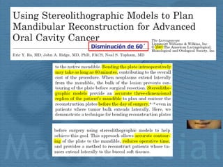 Disminución de 60´ 