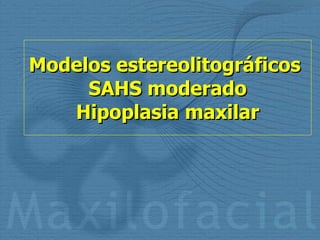 Modelos estereolitográficos  SAHS moderado Hipoplasia maxilar 