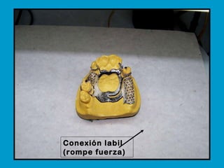 Conexión labil (rompe fuerza)