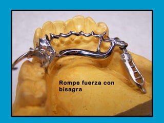 Rompe fuerza con bisagra