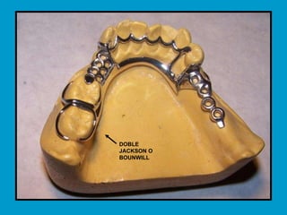 DOBLE JACKSON O BOUNWILL