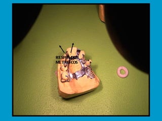 RESPALDOS METÁLICOS