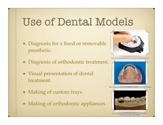 Use of Dental Models
Diagnosis for a ﬁxed or removable
prosthetic.
http://www.summitdentalarts.com/media/7796/plaster-cast.gif

Diagnosis of orthodontic treatment.
Visual presentation of dental
treatment.
http://upload.wikimedia.org/wikipedia/commons/f/f1/Steg_ok_2a.jpg

Making of custom trays.
Making of orthodontic appliances.
http://roguedentalsolutions.com/web/wp-content/gallery/
photo-gallery/pauls-work-007.jpg

 