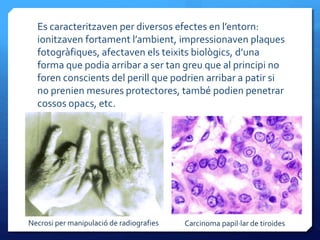 Es caracteritzaven per diversos efectes en l’entorn:
ionitzaven fortament l’ambient, impressionaven plaques
fotogràfiques, afectaven els teixits biològics, d’una
forma que podia arribar a ser tan greu que al principi no
foren conscients del perill que podrien arribar a patir si
no prenien mesures protectores, també podien penetrar
cossos opacs, etc.
Carcinoma papil·lar de tiroidesNecrosi per manipulació de radiografies
 