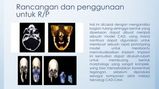 Model atau jenis tengkorak pada Manusia.pptx