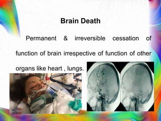 Brain Death
Permanent & irreversible cessation of
function of brain irrespective of function of other
organs like heart , lungs.
21-03-2023 Mr. Melvin Jacob
 