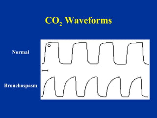Moderate sedation monitoring | PPT
