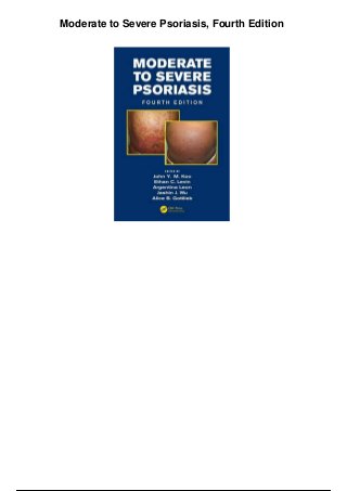 Moderate to Severe Psoriasis, Fourth Edition
 